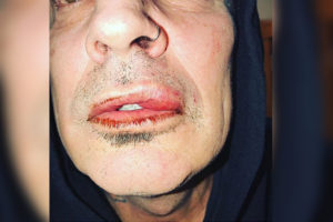 Tommy Lee Allegedly Assaulted By Son